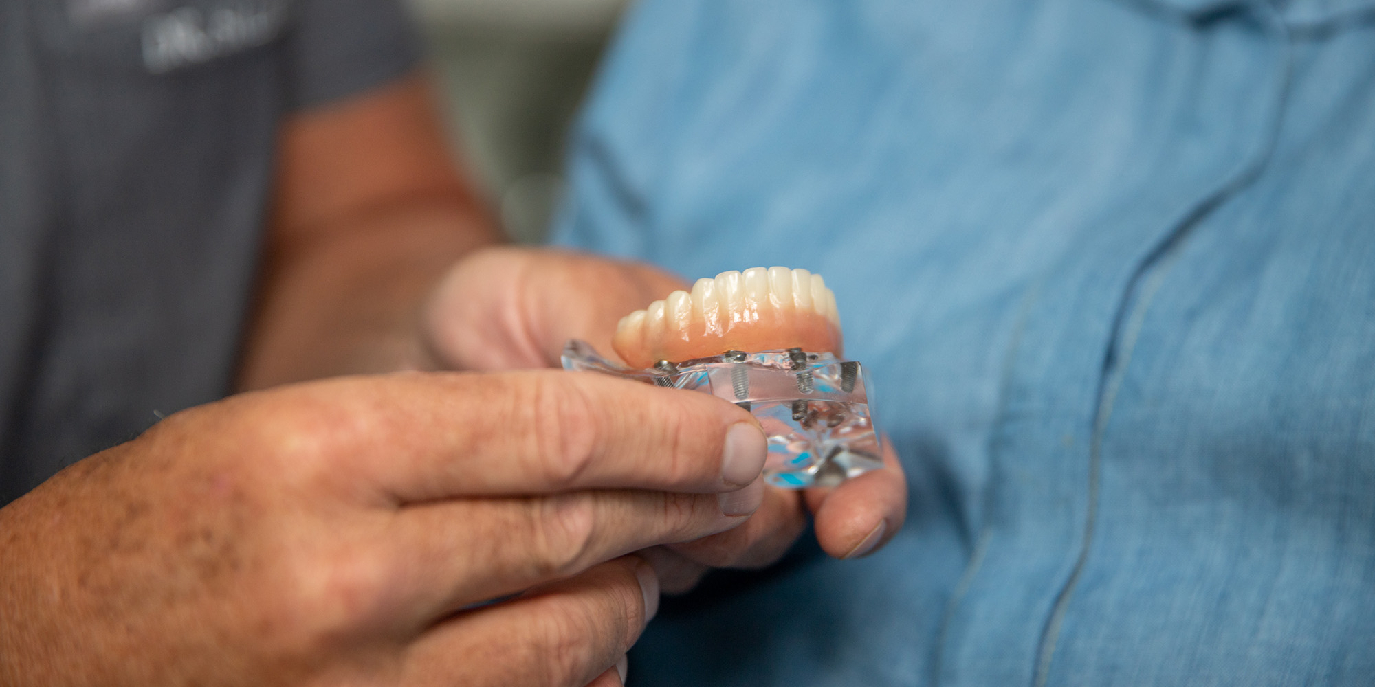Doctor's hands holding a model of a full arch dental prosthesis attached to all-n-4 dental implants