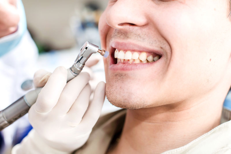 A white adult male smiling undergoing teeth cleaning procedure.