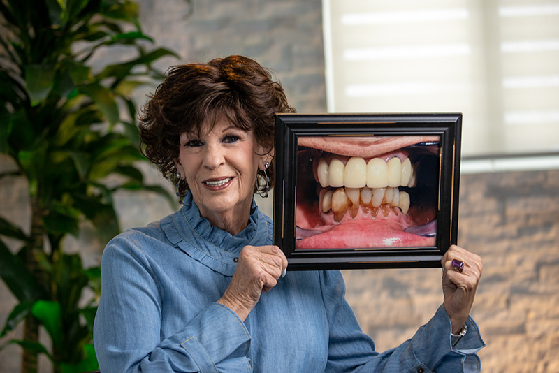 Elderly female patient with brown hair smiling, showing her all-on-4 implants holding a before picture