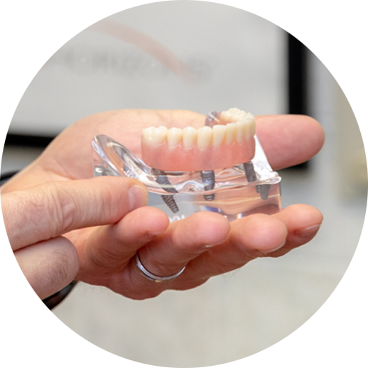 Dr. Silegy's hands holding an lower arch all-on-4 full mouth dental implant model.