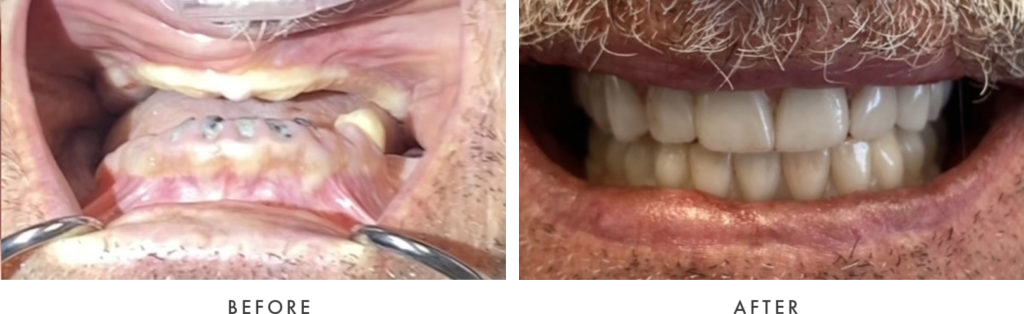 before-after