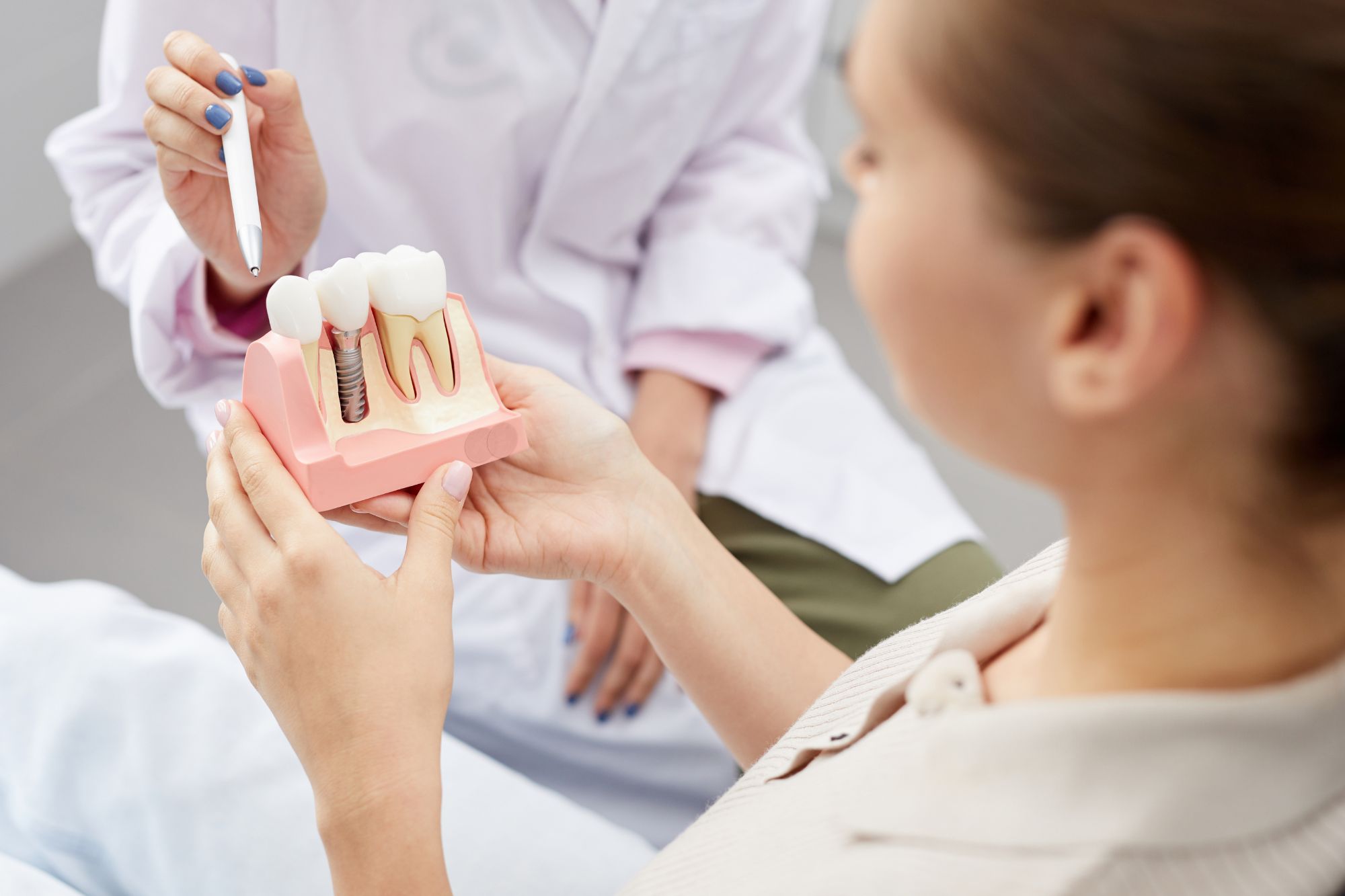doctor showing a dental implant