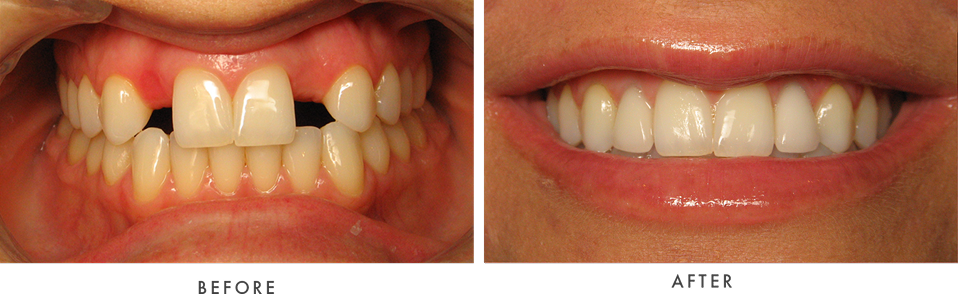 smile-1